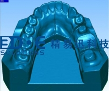 牙齒相關掃描案例——牙模三維掃描案例